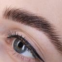 Brow Lift
