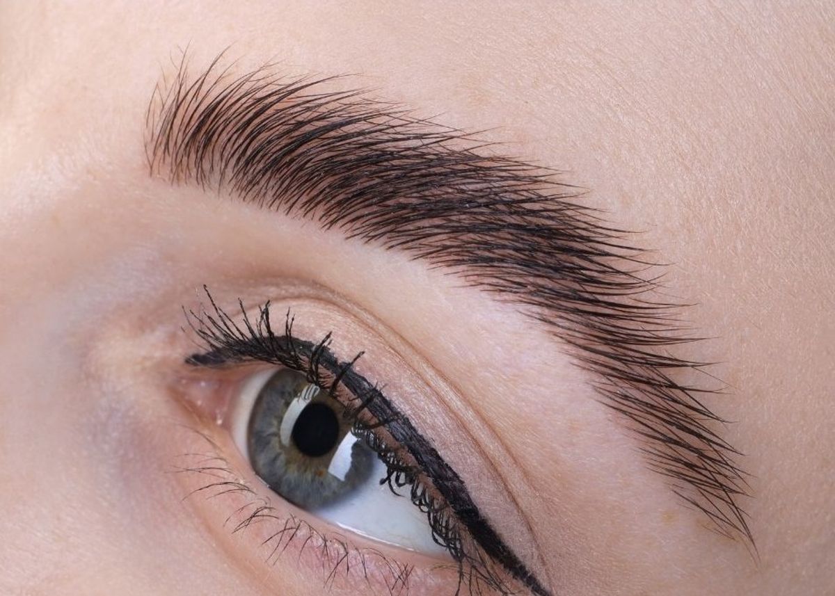 Brow Lift
