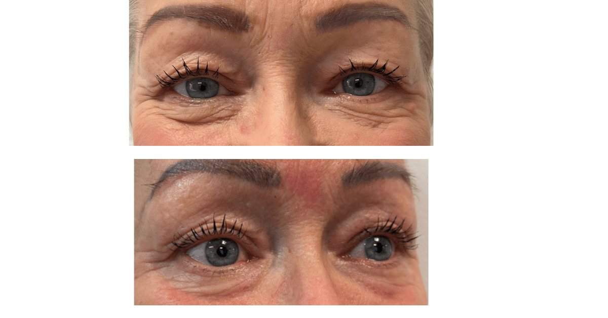 Äkta plasma — varför din plasmapenna kanske inte skapar plasma